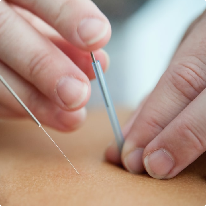 ハロー鍼灸整骨治療院